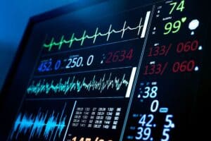 Monitoringsapparatuur leasen